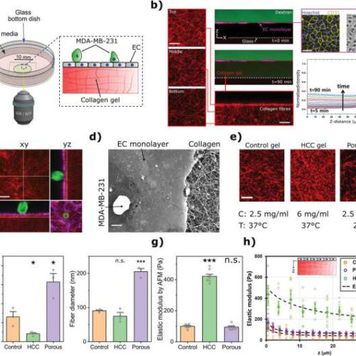 How cancer cells muscle their way into other organs