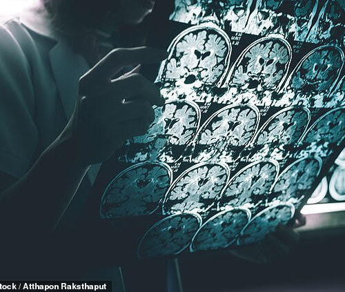 US steps up race for Alzheimer’s cure: NIH to launch $300m research database that tracks medical records of up to 90% of Americans