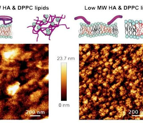 Composition of synovial fluid potential culprit behind osteoarthritis