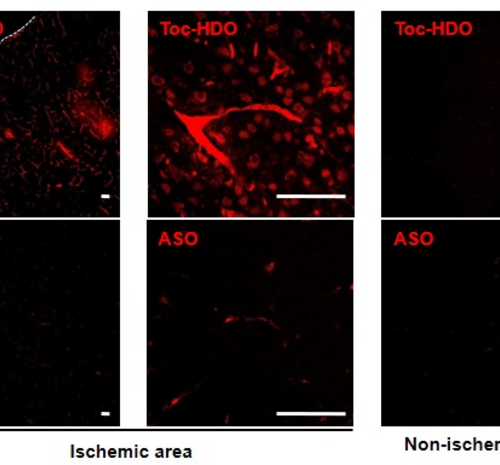 Lipid molecules help to get stroke therapies into the brain