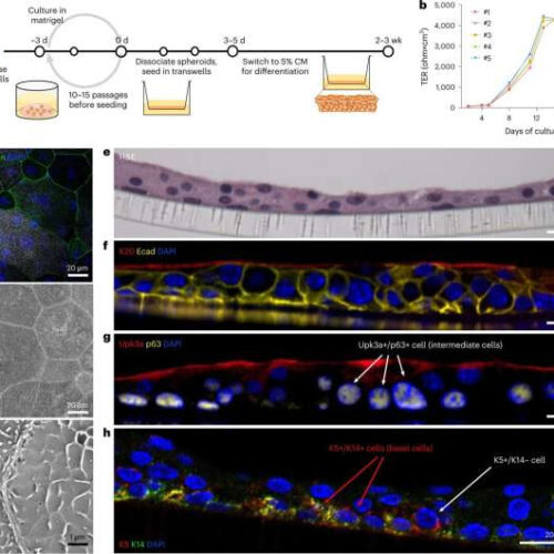 Hidden epigenetic mechanisms behind chronic UTIs found