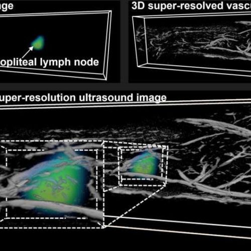 Researchers develop new lower cost, dual-modality imaging technique to facilitate earlier disease detection