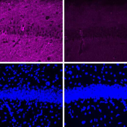 A new peptide may hold potential as an Alzheimer’s treatment