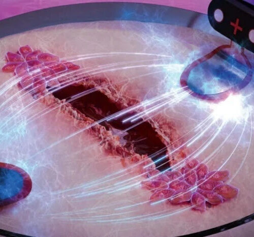 Using electric stimulation to make wounds heal three times faster