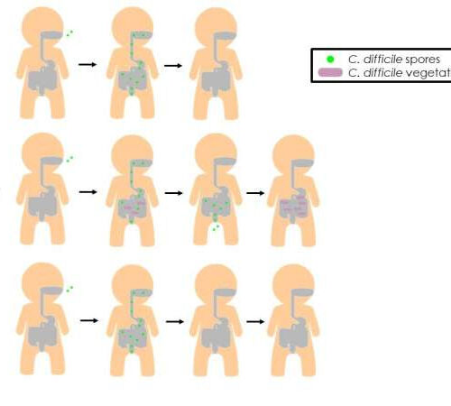 Scientists make critical progress toward preventing C. diff infections