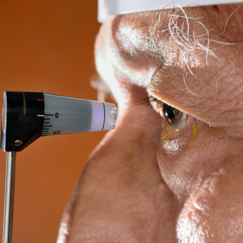 New gene therapy lowers eye pressure to treat glaucoma