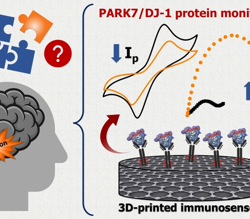 Low-cost sensor detects early-stage Parkinson’s disease in biological samples