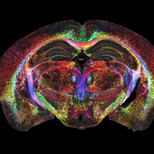 Brain images just got 64 million times sharper