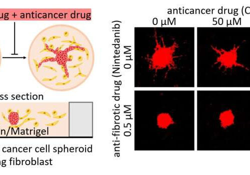 Fibroblast inhibitors assist anti-cancer drugs to suppress cancer growth