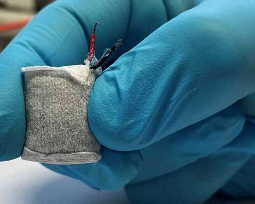 Implantable fuel cell that generates electricity from excess glucose in the blood