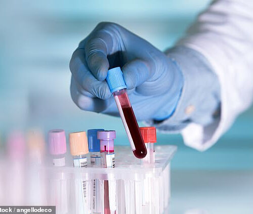 Breakthrough blood test that detects traces of cancer could spare thousands of patients gruelling chemo every year