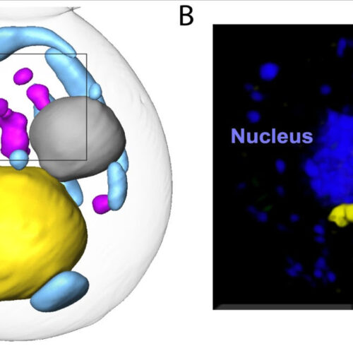 Study finds new pathway for clearing misfolded proteins