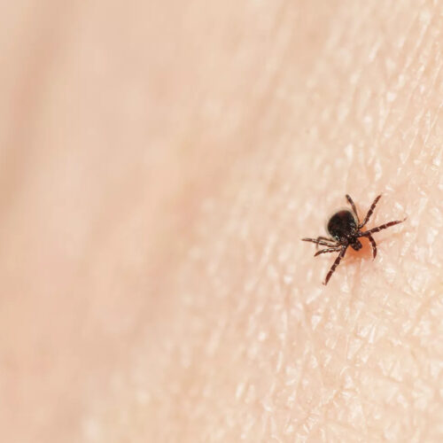What Is Babesiosis? Tickborne Disease on the Rise in the Northeast, CDC Says