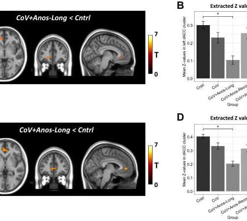 Long COVID smell loss linked to changes in the brain