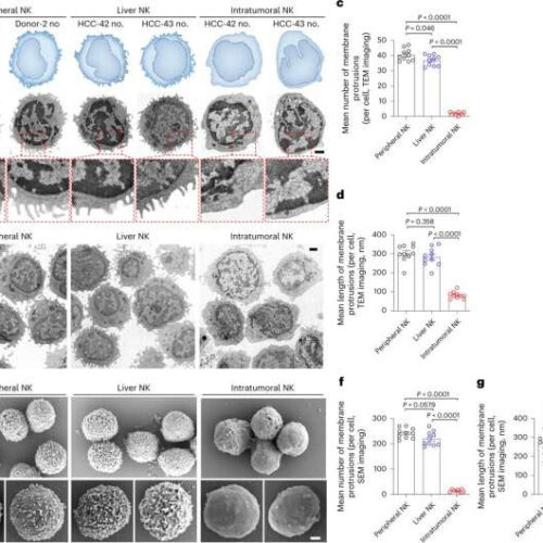 Researchers reveal key mechanism of natural killer cell dysfunction