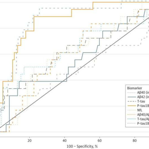 Blood tests may help physicians in low-resource environments diagnose Alzheimer’s disease