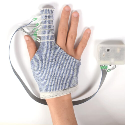 KnitDema glove puts the electronic squeeze on swollen fingers