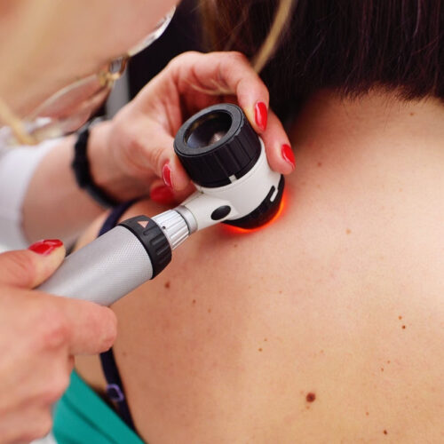 5 skin cancer-care tools you should look out for Stick, scan, and selfie to fight off skin cancer