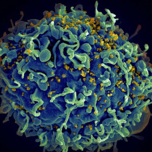 Researchers identify strong T-cell response in first-in-human nanoparticle HIV vaccine