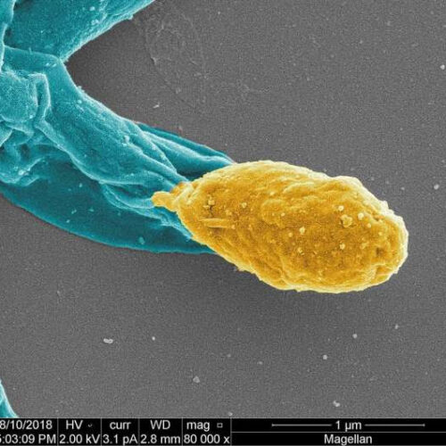 Dual-action antibiotic found that kills C. difficile, preventing reinfections