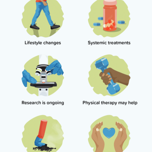 Treating fatigue in ankylosing spondylitis