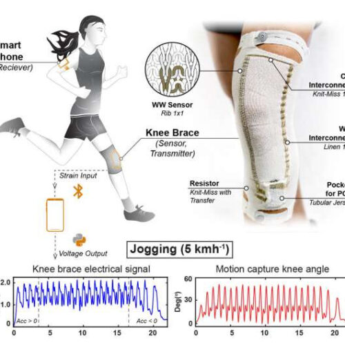 Stretchable knee wearable offers insight into improving e-textiles for health care