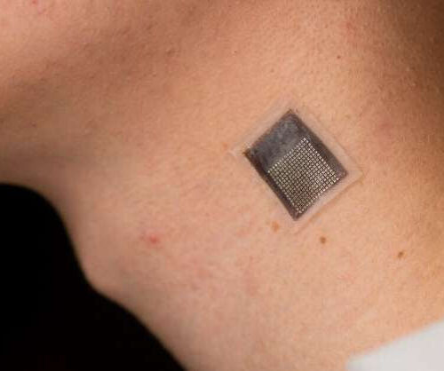 Wearable ultrasound patch provide non-invasive deep tissue monitoring