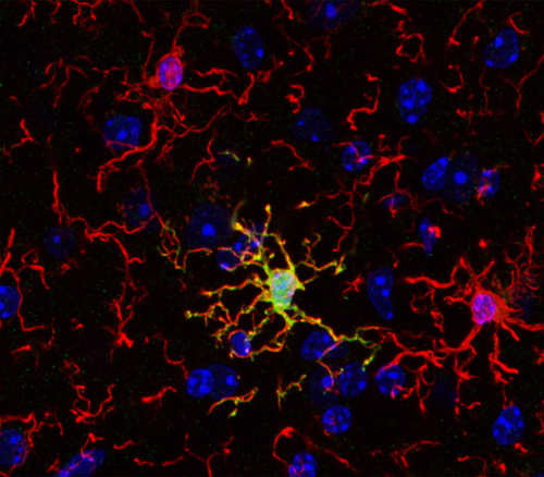 Immune cells of the brain are not all the same – new research could open novel therapeutic pathways