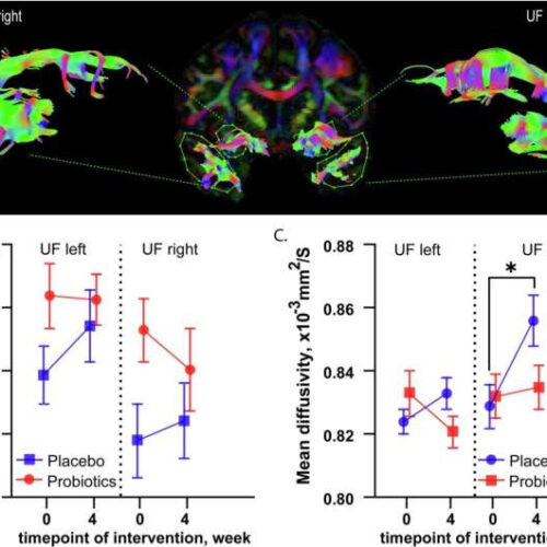 Disrupted gut microbiome involved in depression, finds research