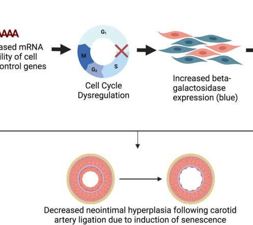 Study identifies a new potential target for treating vascular disease