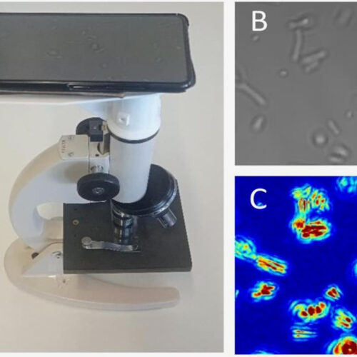 System quickly spots antibiotic-resistant bacteria by watching them shimmy