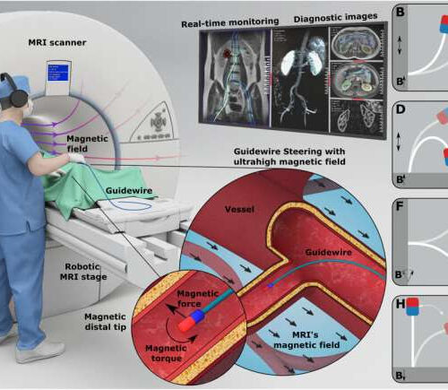 Magnetic guidewire steering at ultrahigh magnetic fields for medical imaging