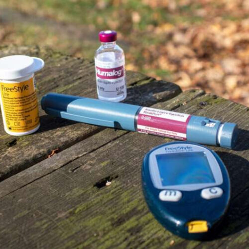 One-hour endoscopic procedure could eliminate need for insulin for type 2 diabetes