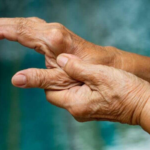 Peresolimab found to be efficacious for rheumatoid arthritis