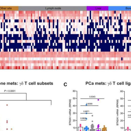 Researchers develop CAR T cells that fight prostate cancer in bone