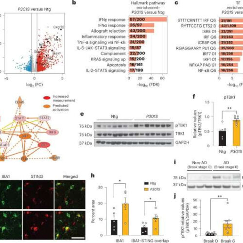 Interfering with antiviral pathway may deter Alzheimer’s disease and frontotemporal dementia