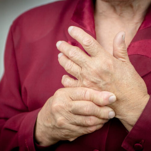 Molecular discovery may mean new treatments for rheumatoid arthritis