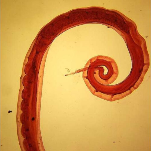 New treatment for human parasitic worm infections shows high efficacy