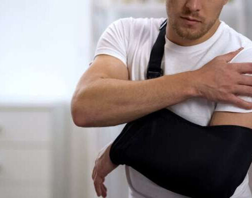 Why exercising your ‘good arm’ can also help the one in a sling