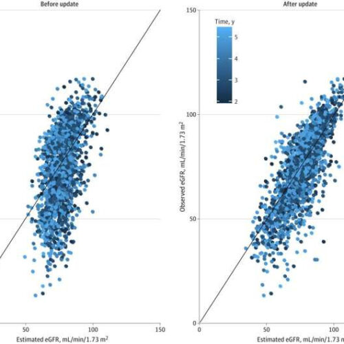 Predictive model developed for complications in diabetes