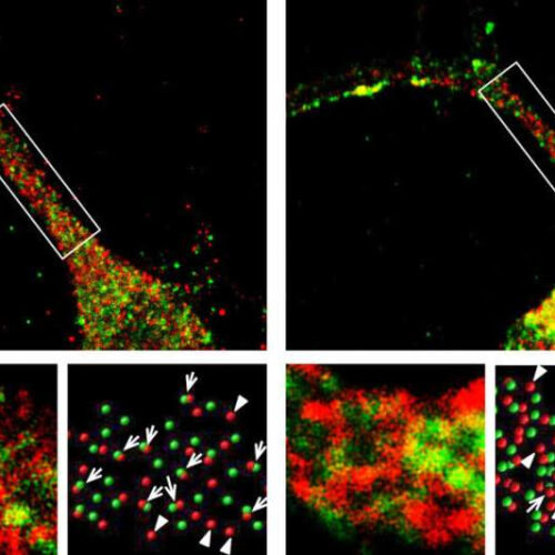 Scientists discover how mutations in a language gene produce speech deficits