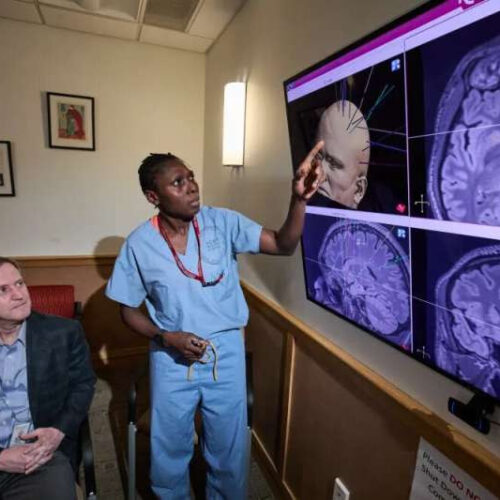 How epilepsy surgery is curing more seizures