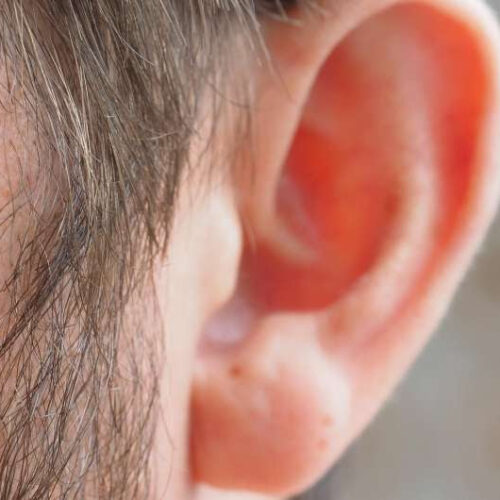 Ear acupuncture with beads may help with shedding pounds