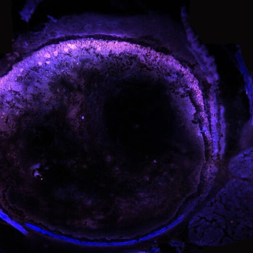 Transforming a Tablet or Smartphone into a Fluorescence Microscope