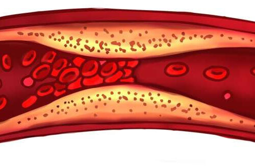 Target for imaging could improve detection of blood clots