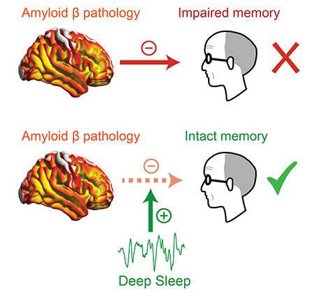Deep sleep may mitigate Alzheimer’s memory loss, research shows