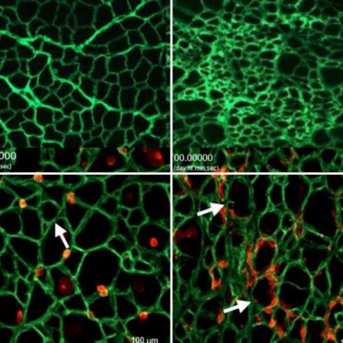 Study: Scarring of collagen ‘highway’ prevents stem cells from healing damaged tissue in Duchenne muscular dystrophy