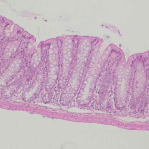 Protein complex mediates protection against intestinal autoinflammation