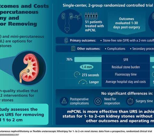 ‘Mini-PCNL’ surgery has higher stone-free rate in treating intermediate-size kidney stones, finds randomized trial