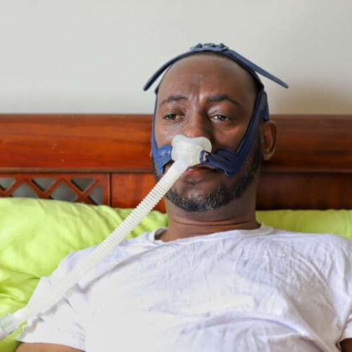The severity of sleep apnea may be underestimated in Black patients